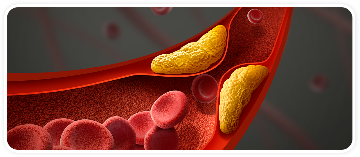 슬개골탈구, 혈관질환, 숫구멍개구 등 질병보험 