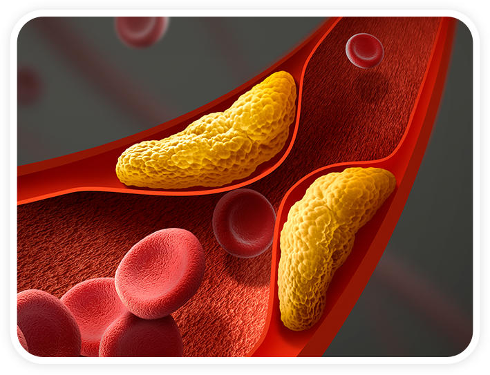 슬개골탈구, 혈관질환, 숫구멍개구 등 질병보험 